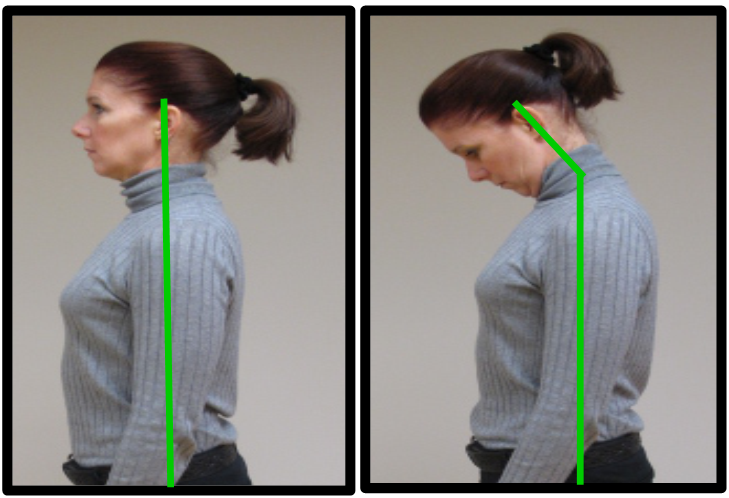 proper neck posture