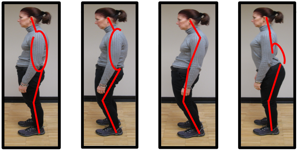 bad core posture