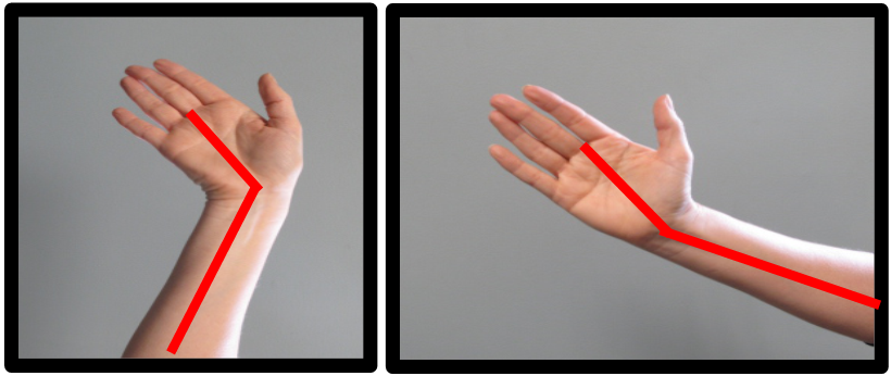 bad wrist posture