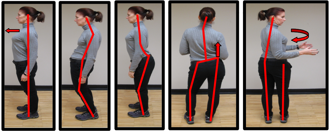 bad lower back posture
